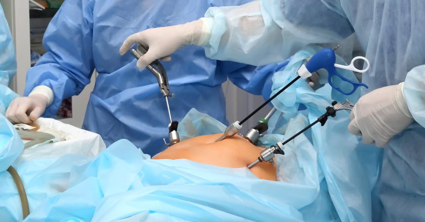 Laparoscopic Training Navigating the Path to Surgical Excellence